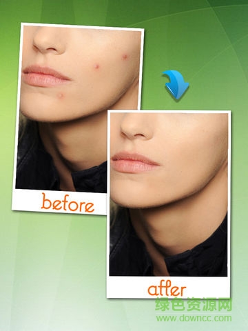 photo eraser中文版 v4.6.6 安卓版2