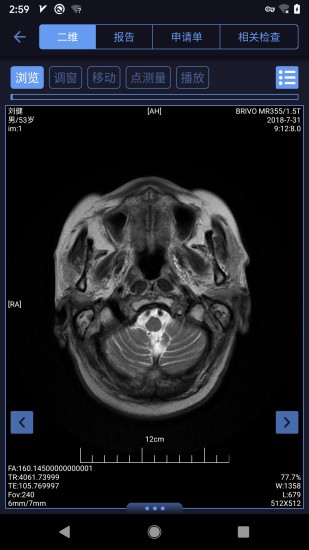 东软睿影官方版 v1.0.0025.000000.00 安卓版1