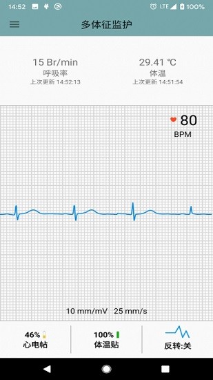 多体征监护(multi vital monitor) v2.1.0.169 安卓版1