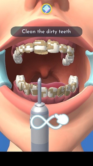完美牙医3d手游 v1.0.3 安卓版0