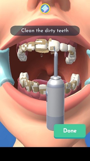 完美牙医3d手游 v1.0.3 安卓版2