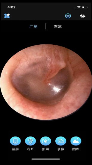 alk可视采耳 v1.3.4 安卓版0