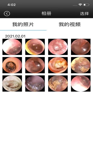 alk可视采耳 v1.3.4 安卓版3